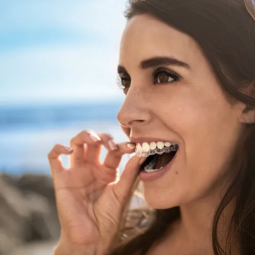 invisalign invisalign
